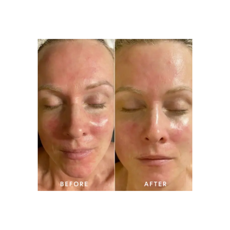 Epicutis Lipid Recovery Mask for Neck 3