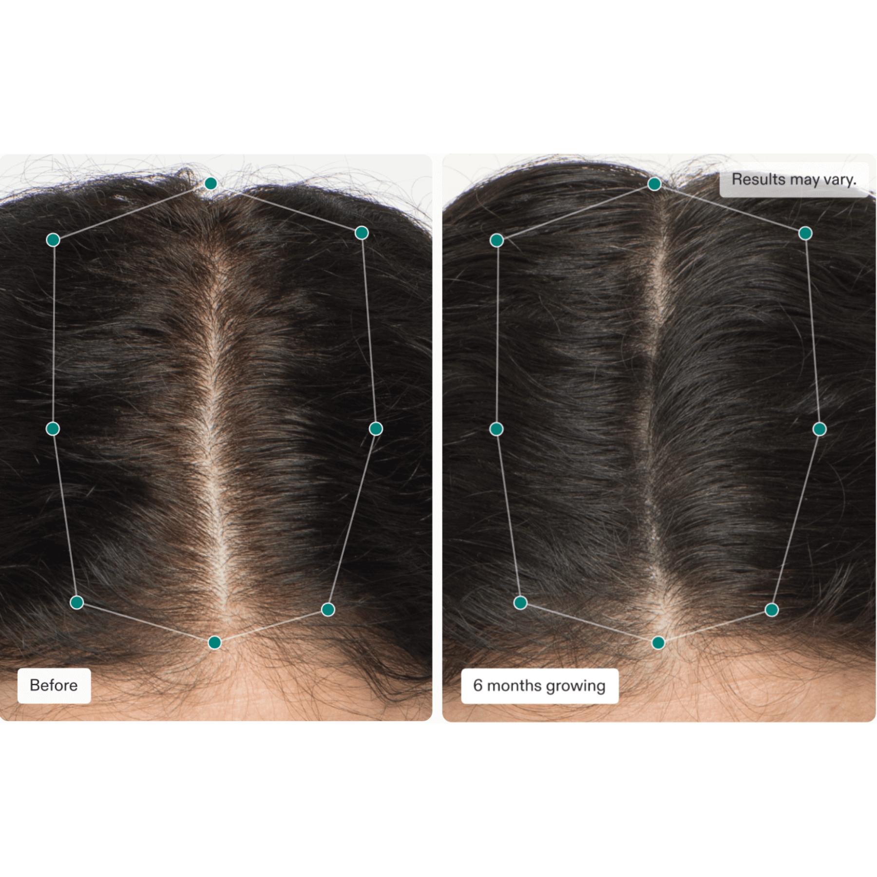 Nutrafol Women Capsules 4