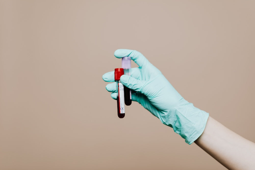 What's Your Metabolic Health Score?