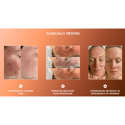 Epicutis Lipid Recovery Mask For Face