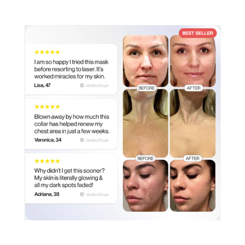 LED Esthetics Glotech™ Mask Pro5